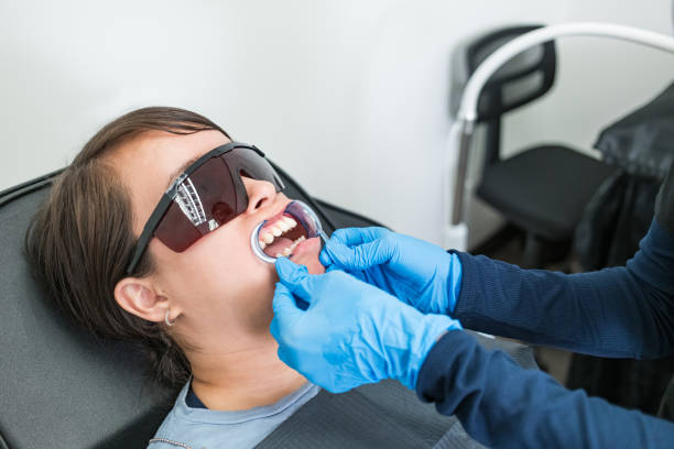Best Emergency Wisdom Tooth Extraction in Idylwood, VA